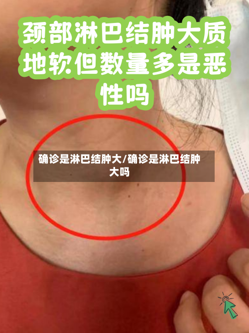 确诊是淋巴结肿大/确诊是淋巴结肿大吗