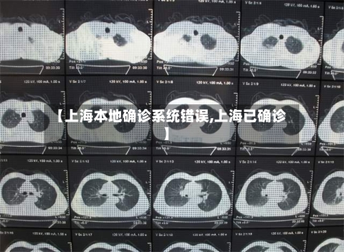 【上海本地确诊系统错误,上海已确诊】