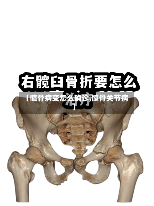 【髋骨病变怎么确诊,髋骨关节病】