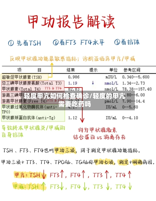 轻度甲亢如何检查确诊/轻度的甲亢需要吃药吗