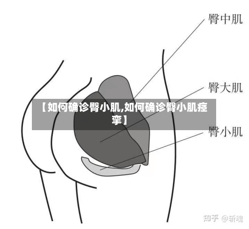 【如何确诊臀小肌,如何确诊臀小肌痉挛】