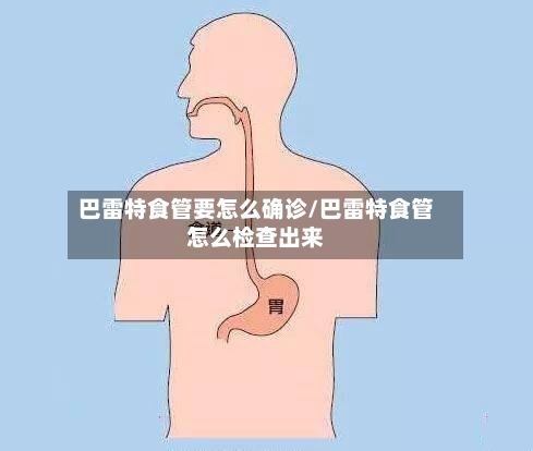 巴雷特食管要怎么确诊/巴雷特食管怎么检查出来